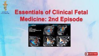 Essentials of Clinical Fetal Medicine: 2nd Episode