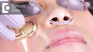 Can laser treatment help in removal of freckles? - Dr. Rajdeep Mysore