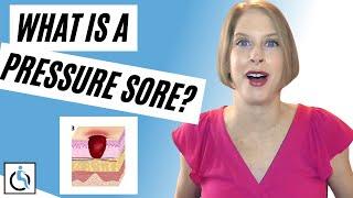 What is a Pressure Sore? | What You Want to Know about Spinal Cord Injuries