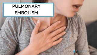 What is a Pulmonary Embolism?! | All you need to know