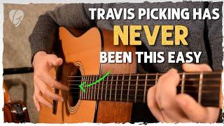 Play Jolene with Easy Travis Picking | Beginner-Friendly Fingerstyle Lesson