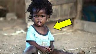 Un uomo adotta una bambina abbandonata dalla Somalia. Guardatela oggi!