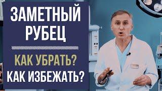 РУБЕЦ  КАК УБРАТЬ ШРАМЫ, КАК ПРЕДОТВРАТИТЬ