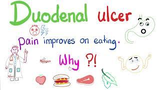 Pain of Duodenal Ulcer Improves on eating…Ever Wonder Why?