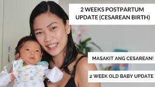 2 weeks POST PARTUM UPDATE ni MOMMY | Cesarean Section BIRTH by Mommy Ruth