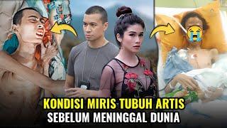 Potret 8 Artis Meninggal Dunia Dengan Kondisi Tubuh yang Memprihatinkan