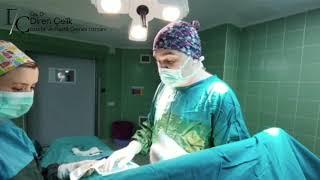 Crisalix ile Meme Protezi Ameliyatı - Op. Dr. Diren Çelik
