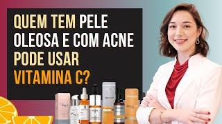 VITAMINA C  para pele oleosa e com acne qual a melhor? | Skincare PELE OLEOSA