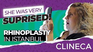 She Fell in Love with her Nose! | #Rhinoplasty in Turkey