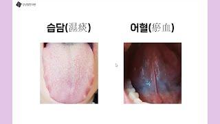 습담개선탕 5분 설명 영상(장정원 원장님)