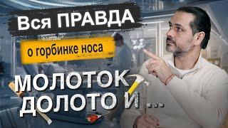 Как убрать горбинку на носу: правда о современной ринопластике