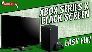 XBOX SERIES X BLACK SCREEN || EASY FIX (June 2024)