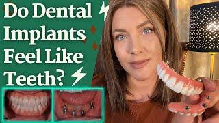 Do Dental Implants Feel Like Teeth?