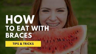 How to Eat Food with BRACES | Foods You Should Eat / Avoid