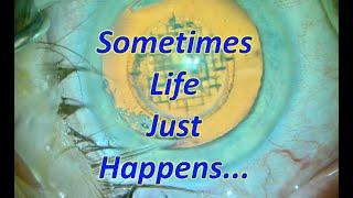 Life Happens...Panoptix insertion with capsule break during surgery.  Shannon Wong, MD. 2-8-2020