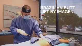 Brazilian Butt Lift | Omaha Liposuction by Imagen