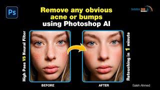 How to get rid of any visible spot or pimples in 1minute | High Pass vs Photoshop AI (Neural Filter)