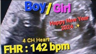 Best of 2023 Ultrasound Dr Samra Ke Sath | Genderreveal | Fetal heartbeat | Baby Girl/boy | Placenta