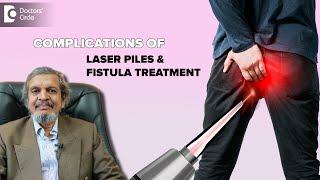 Side effects of Laser Surgery for treating Piles and Fistula?  - Dr. Rajasekhar M R| Doctors' Circle