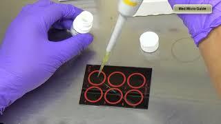 Antistreptolysin O (ASO) test lecture