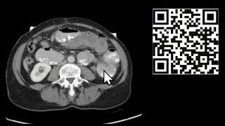 Mastering CT Abdomen and Pelvis: Emergency Course