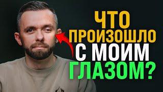 Что произошло с моим глазом?