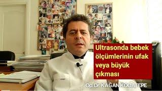 ULTRASONDA KAFASI BÜYÜK (KOCA KAFALI)/KÜÇÜK (MİKROSEFALİ), ZAYIF/KİLOLU, KISA/UZUN BOYLU BEBEKLER!