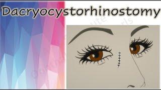 Dacryocystorhinostomy  |  DCR