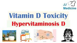 Vitamin D Toxicity (Hypervitaminosis D) | Causes, Pathophysiology, Symptoms, Diagnosis, Treatment