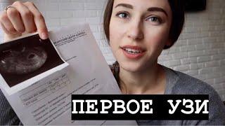 ПЕРВОЕ УЗИОТСЛОЙКА / ТОКСИКОЗ / 5- 7 НЕДЕЛЬ БЕРЕМЕННОСТИ