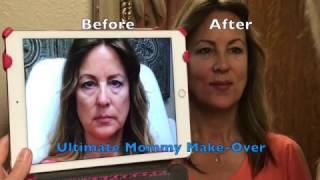 LIQUID FACELIFT - ULTIMATE MOMMY MAKEOVER!