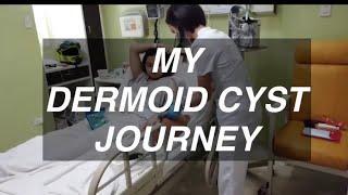 MY DERMOID CYST JOURNEY | Vlog 24 | Camille T. Vlogs