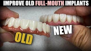 How to Improve Old Full-Mouth Implants