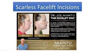 Facelift Incisions and Scars: Don't Have Facelift Surgery Without Watching This!