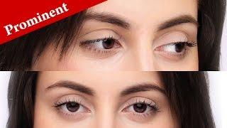 How to immediately know if your eyes are PROMINENT or PROTRUDING?