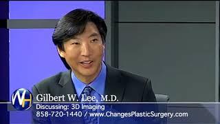 3D Imaging with San Diego, CA Plastic Surgeon, Gilbert Lee, M D