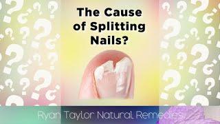 Cause Of Splitting Nails?