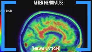 Study reveals how menopause causes brain fog | Vargas Reports
