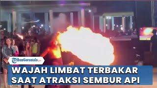 Wajah Pesulap Limbad Terbakar saat Atraksi Sembur Api, Dilakukan Operasi Kecil