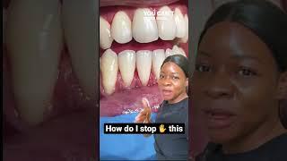 This stops gums from receding #shorts #dentist #viral #youtube #videooftheday #teeth #smile #foryou