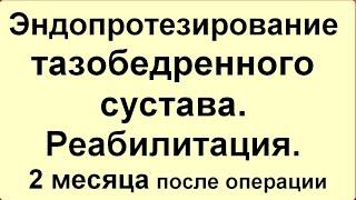 Эндопротезирование тазобедренного сустава. Реабилитация. 2 месяца после операции