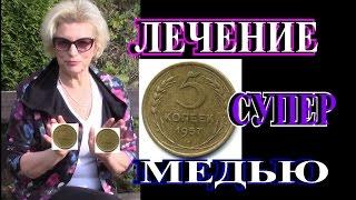 КАК и ЧТО ЛЕЧИТЬ МЕДЬЮ▶ВЫ БУДЕТЕ УДИВЛЕНЫ▶TEFI ГЕРМАНИЯ