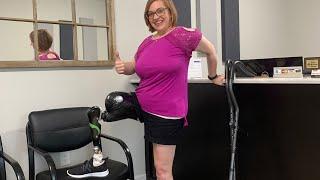 Above Knee Amputee - First Prosthetic Leg - Bringing It Home With Me!