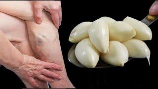 Leg pain, rheumatism, varicose veins, arthritis, headache, joint pain. Mom's Natural Remedy