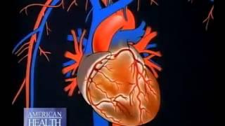 Detecting Heart Disease with Calcium Score - Scottsdale Medical Imaging