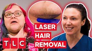 Dr. Emma Helps A Woman With Excess Facial Hair! | The Bad Skin Clinic