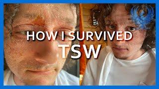 How I Survived Topical Steroid Withdrawal | EP: 12