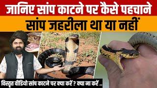 Snake Bite Situation | जानिए सांप काटने की स्थिति में क्या करना चाहिए और क्या नहीं करना चाहिए