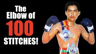 The Elbow Hunter of 100 Stitches Explained - Yodkhunpon Technique Breakdown