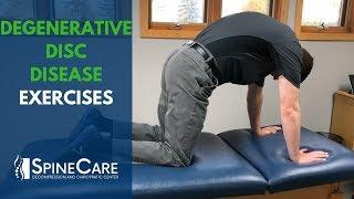 Degenerative Disc Disease Exercises | SpineCare St. Joseph, MI Chiropractic